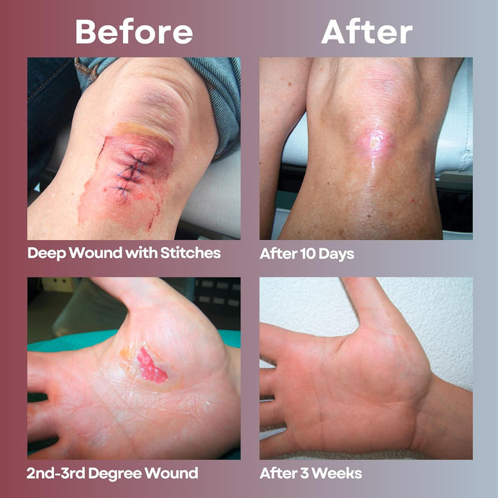 MediQuick Wound Gel Drops (4oz ) First Aid works on contact and lasts for 12 hours. Stays in the wound or where applied. Non-toxic, Sting Free, and helps to speed Healing Cuts, Acne, Burns, Eczema Itch, Rashes & More. Adults Kid & Pets All Natural