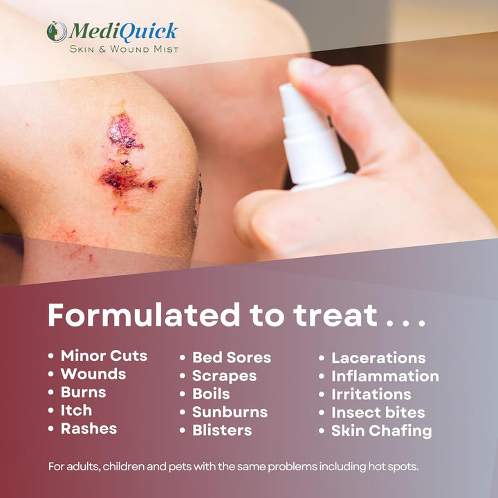 MediQuick Wound Gel Drops (4oz ) First Aid works on contact and lasts for 12 hours. Stays in the wound or where applied. Non-toxic, Sting Free, and helps to speed Healing Cuts, Acne, Burns, Eczema Itch, Rashes & More. Adults Kid & Pets All Natural