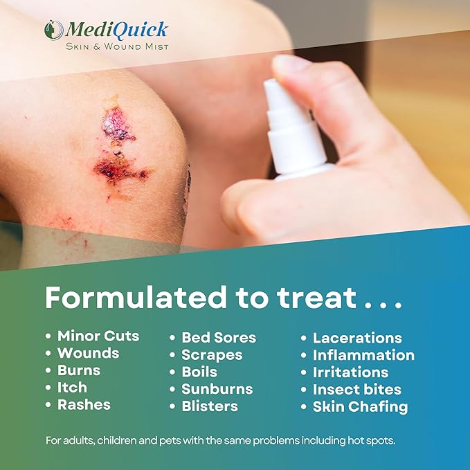 MediQuick Gel (4oz) First Aid Spray: Smooth consistency, covers large areas, cleans and speeds healing. Starts on contact, lasts 12 hours. No Sting. Ideal for Cuts, Burns, Acne, Itchy Eczema, Rashes & more. Safe for Adults, Kids & Pets. All Natural.